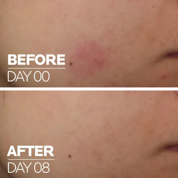 Cicaplast Lèvres – Bálsamo Barrera Reparador 30 ml - Imagen 3
