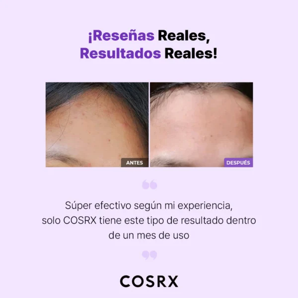 COSRX AHA/BHA Clarifying Treatment Toner 150 ml - Imagen 3